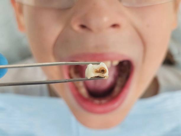 Best Emergency Treatment for Toothache in Fayetteville, AR