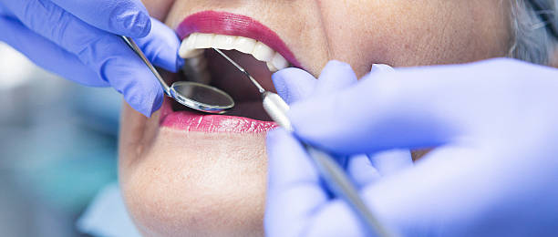 Best Emergency Root Canal Treatment in Fayetteville, AR
